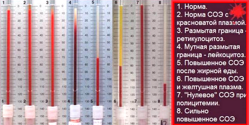причина повышенной СОЭ