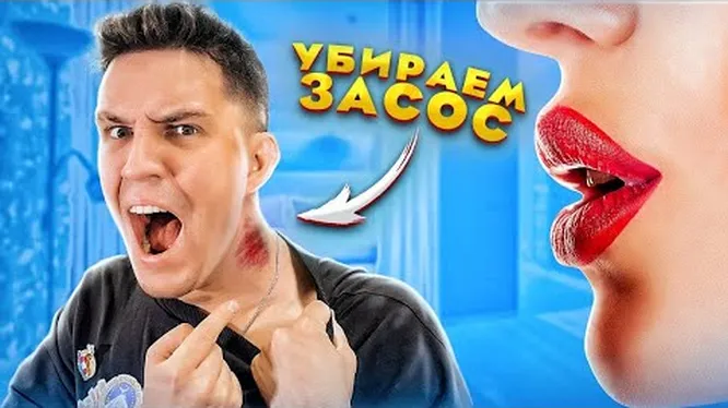 Как убрать засос в домашних условиях