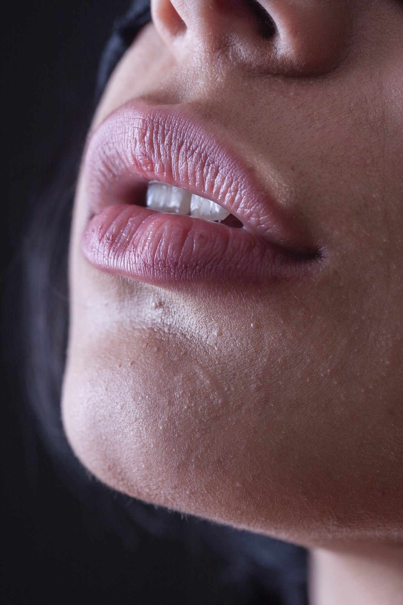 Почему губы меняют цвет: осторожно, это может быть симптомом тяжелых заболеваний