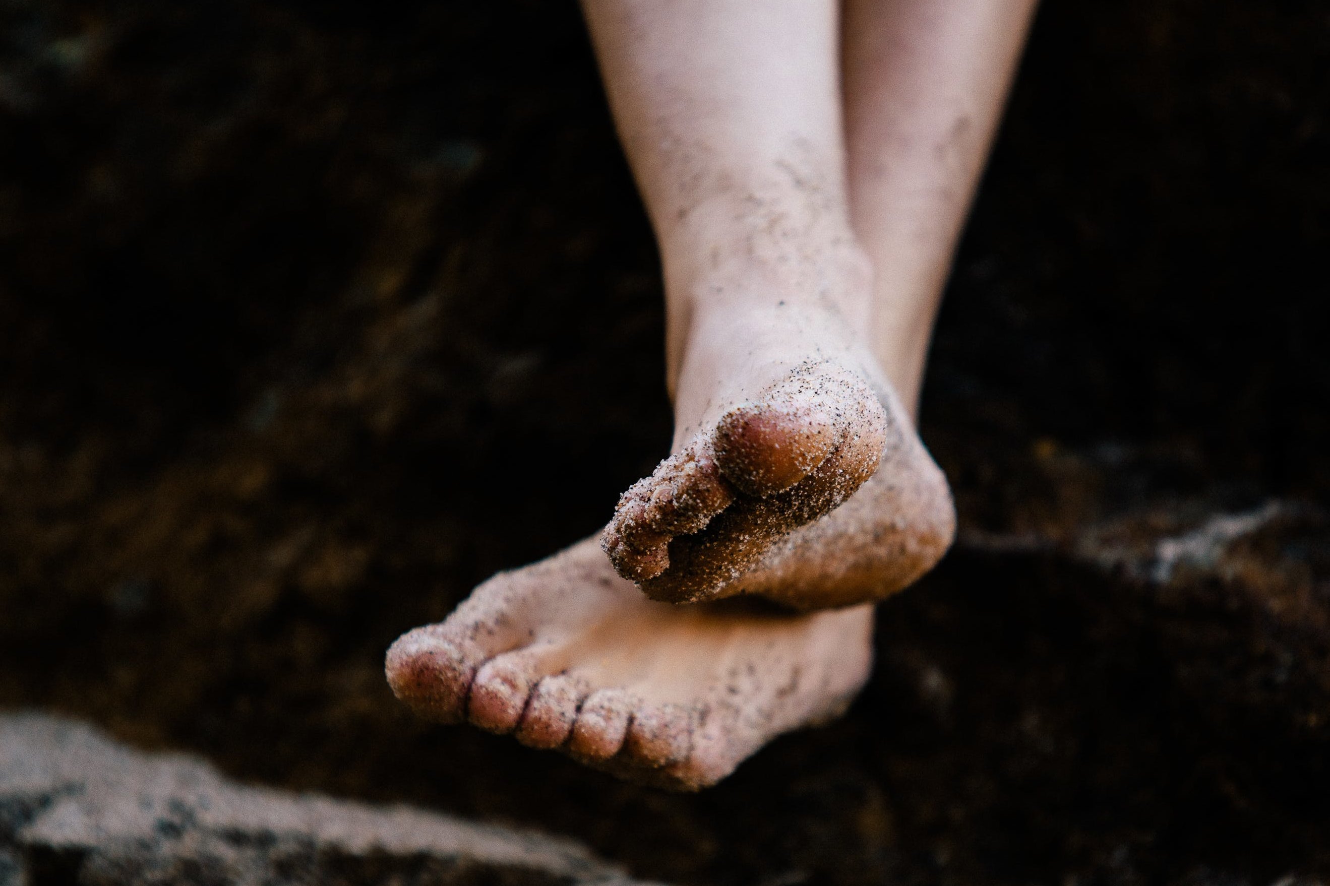 Появились признаки сухой кожи на ногах: что делать