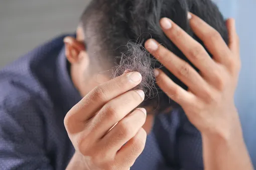 Какой популярный среди мужчин продукт влияет на выпадение волос