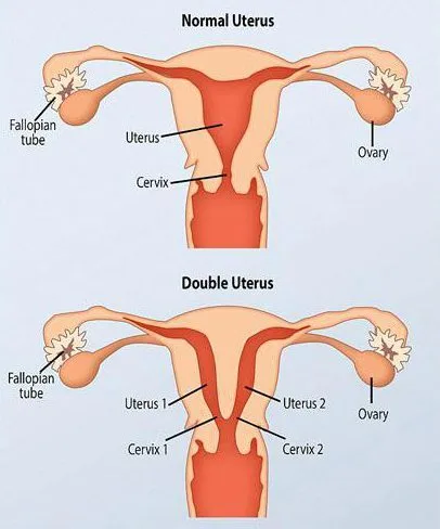 Фото девушки с двумя вагинами