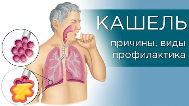 Как лечить кашель: 6 эффективных способов | kormstroytorg.ru